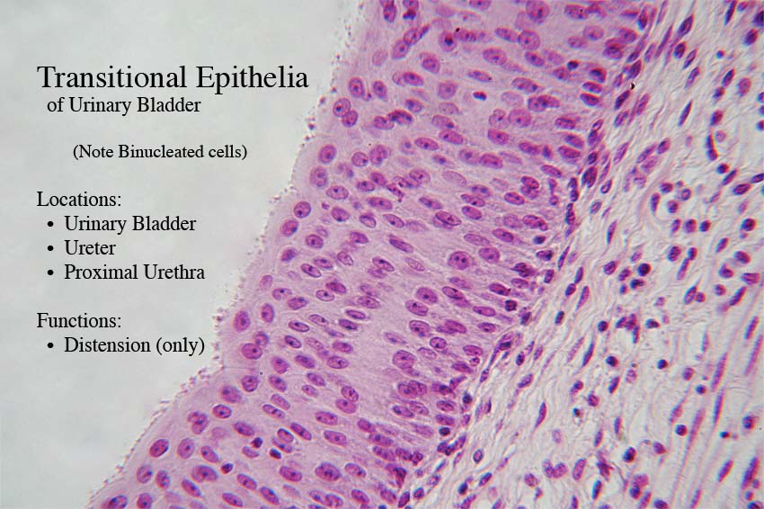 type of tissue lining urinary bladder